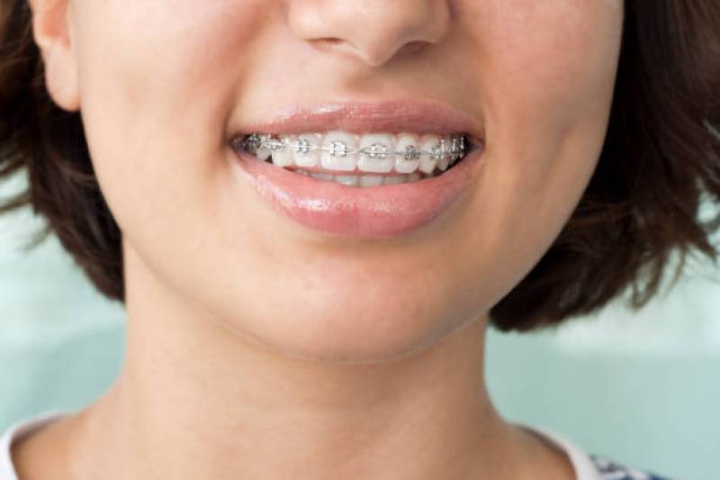 Prévoyance et Retraite personnalisées pour les orthodontistes